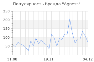 Популярность бренда agness
